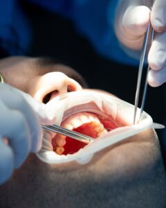 odontoavila-imagenes-5